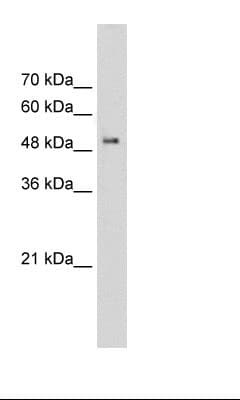 Syndapin I / PACSIN1 Antibody (aa311-360)