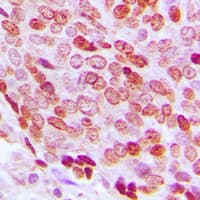 FOXD3 Antibody (Internal)