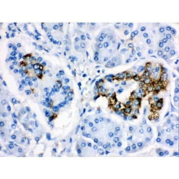 CYP24 / CYP24A1 Antibody (aa153-514)