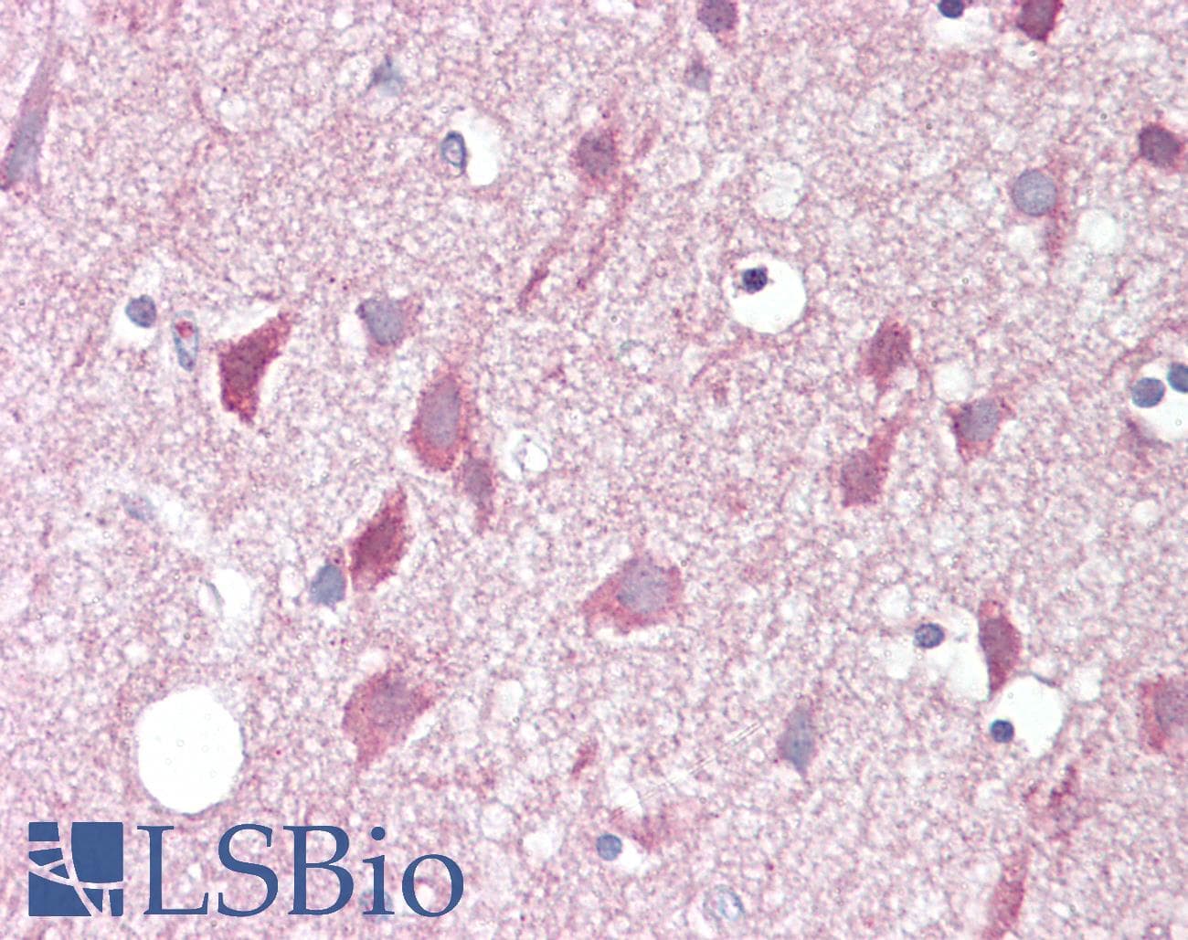 IHC-plus™ ZBTB6 Antibody