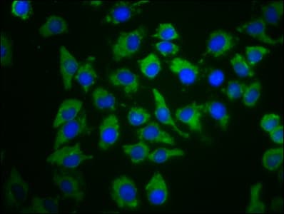 Polyclonal Rabbit anti-Human PDE6C Antibody (IF, WB)