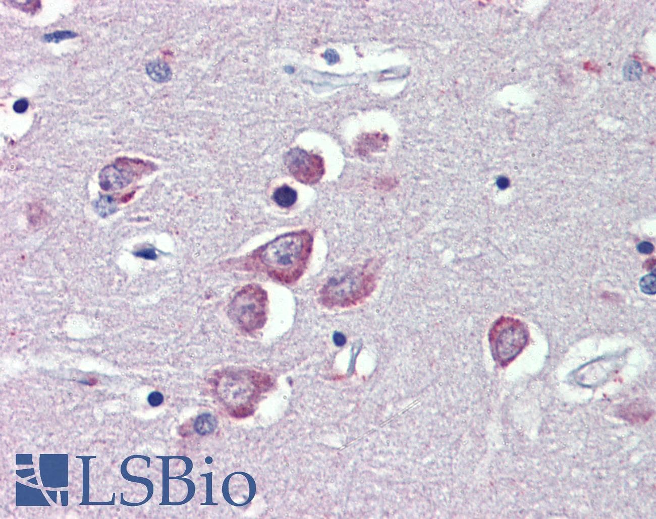 IHC-plus™ TRPM2 Antibody (aa1139-1150)