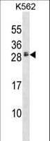 HBEGF / HB EGF Antibody (aa68-96)