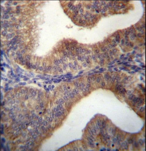 SLC29A3 / ENT3 Antibody (aa21-50)