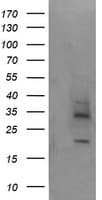 MAGEA4 Antibody (clone OTI2C1)