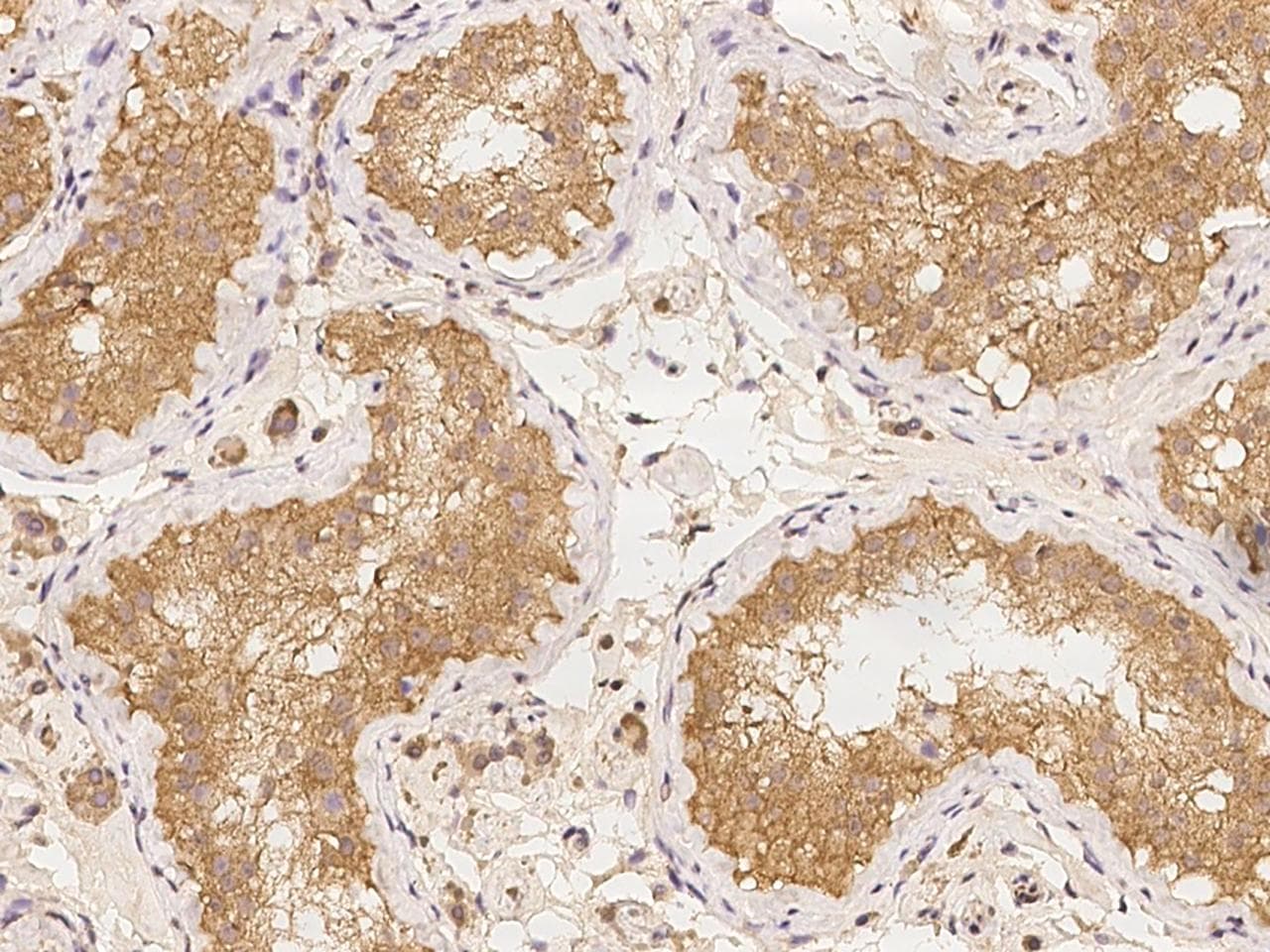 LRRC50 Antibody