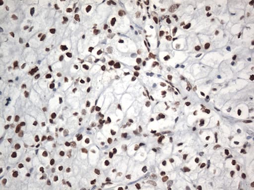 EWSR1 / EWS Antibody (aa256-447, clone OTI2B3, Carrier-free)