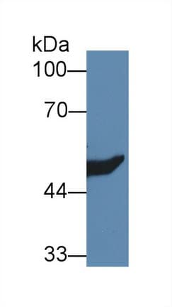 HMGCS2 / HMG-CoA Synthase 2 Antibody