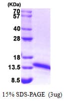 Human FDX1 / ADX Protein (Recombinant)