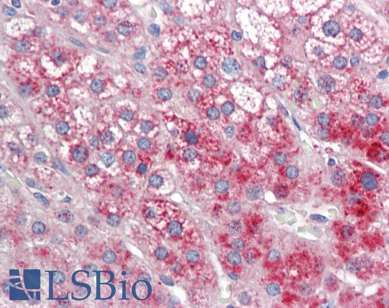 IHC-plus™ DCP2 Antibody