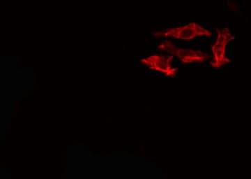 Polyclonal Rabbit anti-Human GZMK / Granzyme K Antibody (IHC, IF, WB)