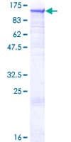 Human DNM2 / Dynamin-2 Protein (Recombinant GST)