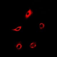 Polyclonal Rabbit anti-Human PPP4C Antibody (IHC, IF, WB)