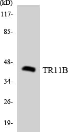 OPG / Osteoprotegerin Antibody (aa25-74)