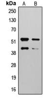 MMP10 Antibody (Internal)