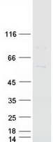 Human CYP7B1 Protein (Recombinant Myc-DDK (Flag))