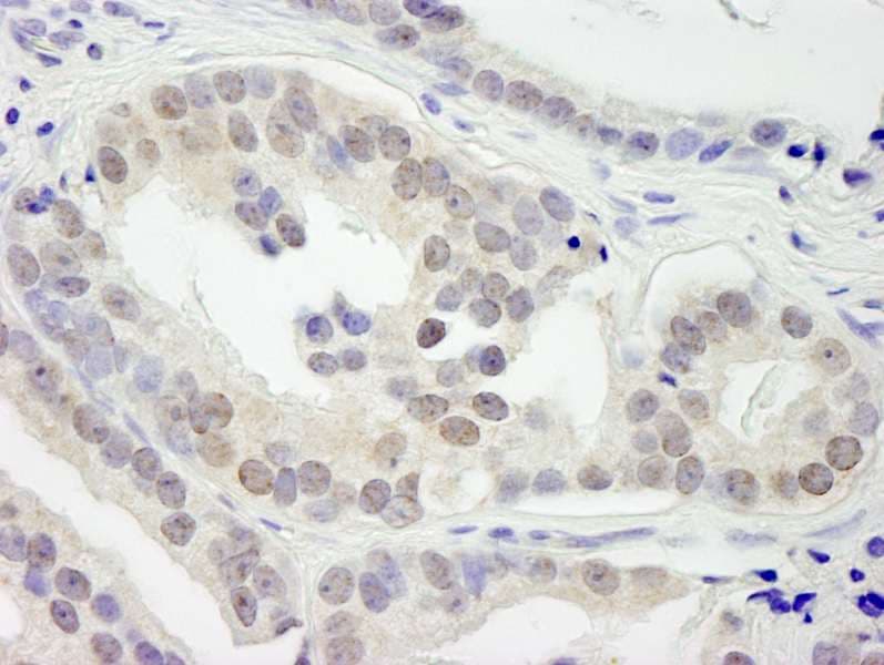KDM3B / JMJD1B Antibody (aa1710-C-term)
