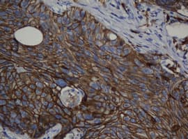 CDH1 / E Cadherin Antibody (clone OTI1B11)