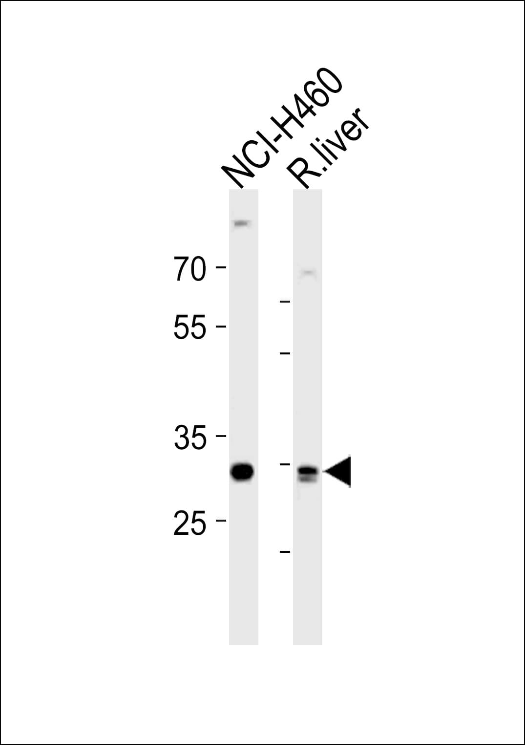 CALB1 / Calbindin Antibody (aa90-116)