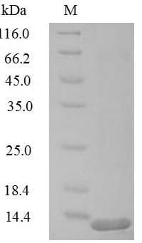 Human RFC1 / RFC Protein (Recombinant 6His, N-terminus)