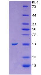 Bovine Angiogenin / ANG Protein (Recombinant 6His, N-terminus)