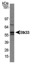 STK33 Antibody (aa1-150)