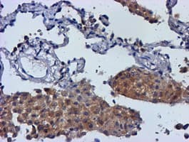 MGLL / Monoacylglycerol Lipase Antibody (clone OTI1H2, Carrier-free)