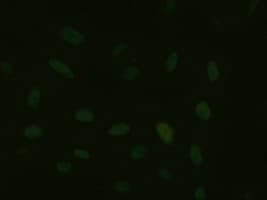 Monoclonal Mouse anti-Human ONECUT1 / HNF6 Antibody (clone OTI4F12, IHC, IF, WB)