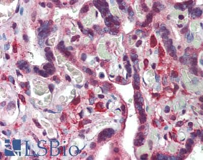IHC-plus™ Polyclonal Rabbit anti-Human LGMN / Legumain Antibody (IHC, WB)