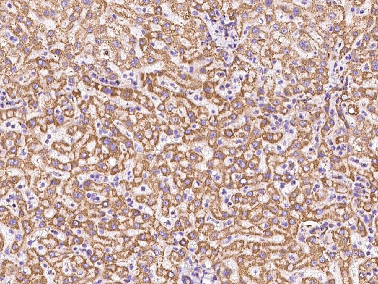 ATP5O Antibody