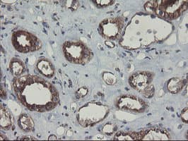 GCP60 / ACBD3 Antibody (clone OTI1B5)