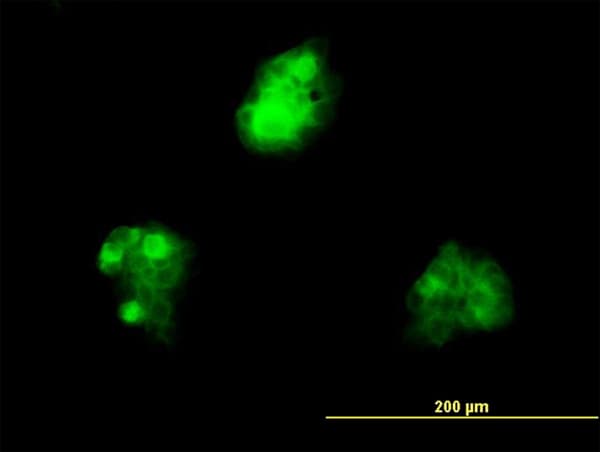 KHDRBS1 / SAM68 Antibody (clone 1A4)