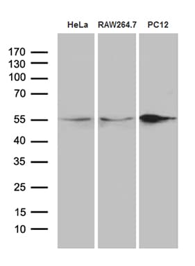 SNX4 Antibody (aa146-450, clone OTI1B1)
