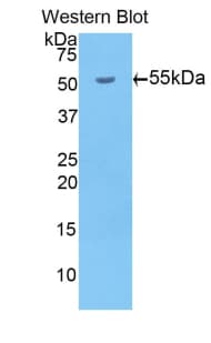 BACE1 / BACE Antibody (aa190-430)