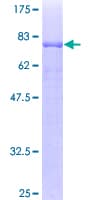 Human TASP1 Protein (Recombinant GST)