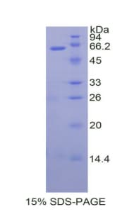 Human TFPI / LACI Protein (Recombinant His-GST)