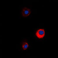 Polyclonal Rabbit anti-Human MUC13 Antibody (C-Terminus, IHC, IF, WB)