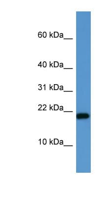 SH2D1A / SAP Antibody (C-Terminus)