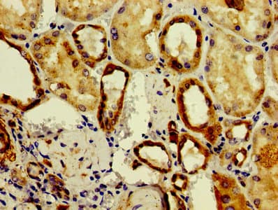 Polyclonal Rabbit anti-Human ASAH2 Antibody