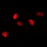 NIFK / MKI67IP Antibody (Internal)