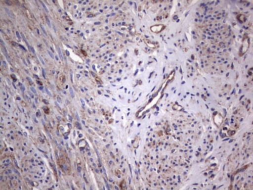 GARS / Glycyl tRNA Synthetase Antibody (clone OTI4G4)