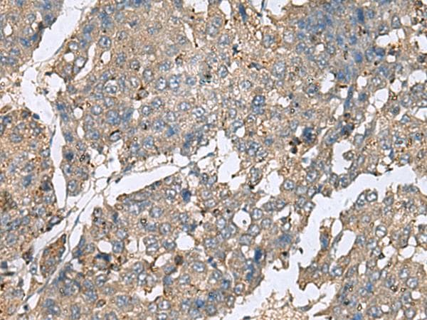 PLA2G2A / SPLA2 Antibody