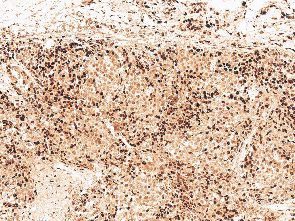 GSK3B / GSK3 Beta Antibody (FITC)