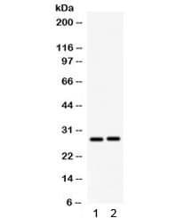 Polyclonal Rabbit anti-Mouse IGFBP1 Antibody (WB)