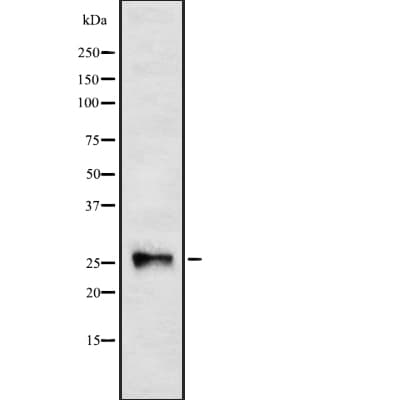 NOG / Noggin Antibody