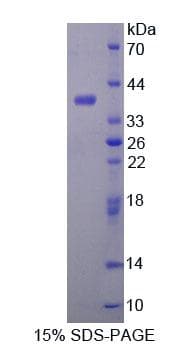 Mouse ALDH1A1 / ALDH1 Protein (Recombinant His-T7, N-terminus)