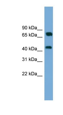 MAT2A Antibody (Internal)