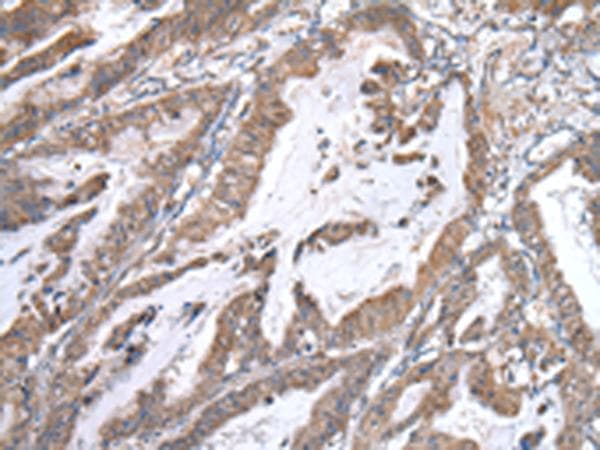 WWP1 Antibody
