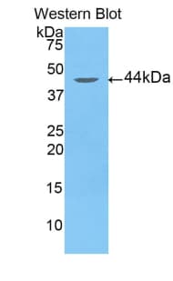 ARRB2 / Beta Arrestin 2 Antibody (aa262-430)
