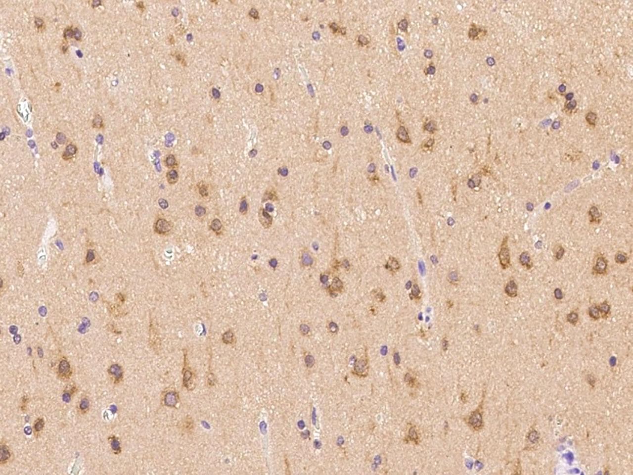 PFDN1 Antibody
